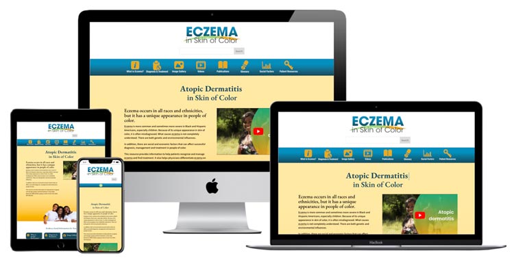 Mockup of Eczema in Skin of Color website on various screen sizes